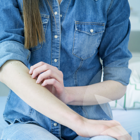 Can CBD Reduce Eczema Caused By Stress?