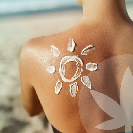 Can CBD Treat Sunburn?